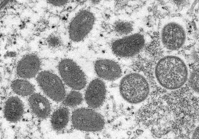 black and white electron microscope image showing oval-shaped mature monkeypox virions as well as rounder immature ones